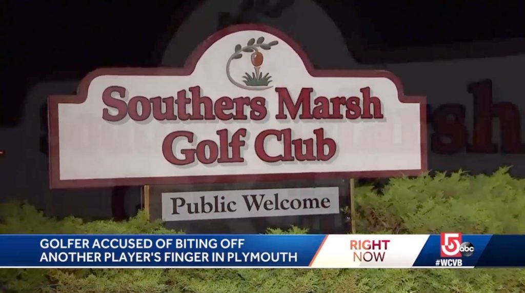 Man bites off finger during golf course fight in Massachusetts