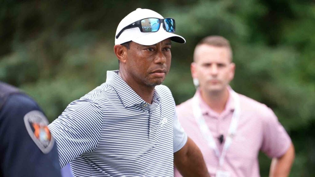 What does Tiger Woods’ injured right leg look like? New photos show scars