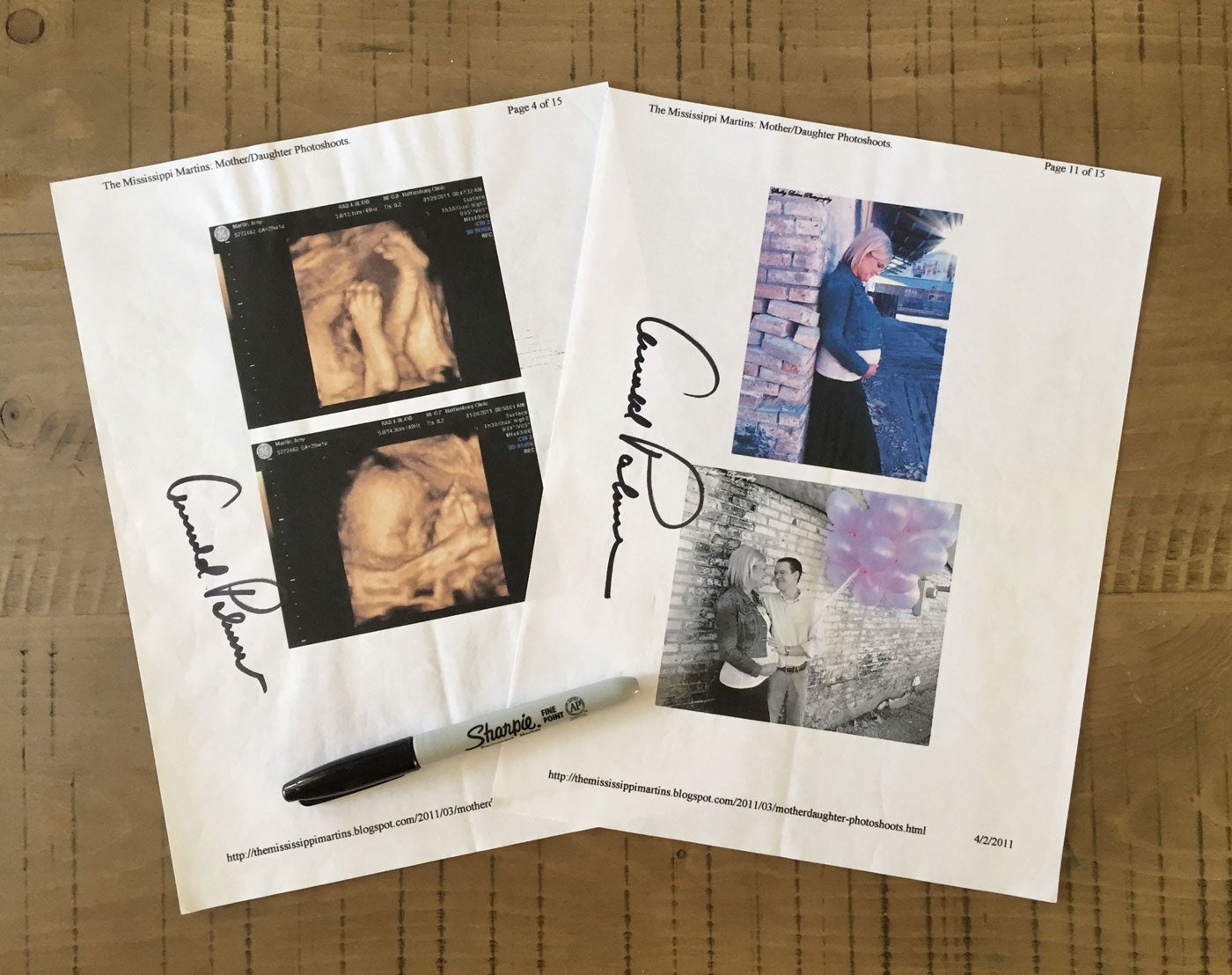 Amy Martin's ultrasound, signed by Arnold Palmer.